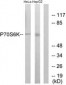 RPS6KB1 / P70S6K / S6K Antibody (aa337-386)